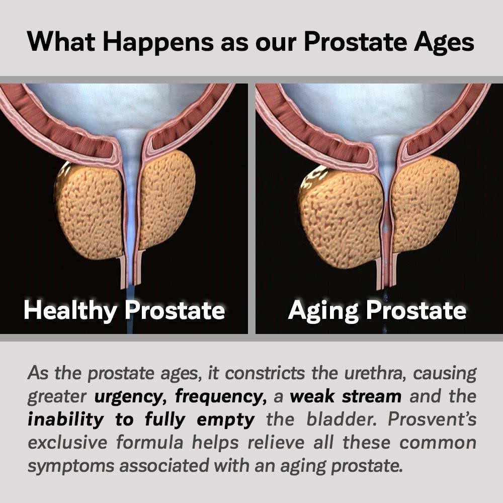 Natural Prostate Health Supplement C4362
